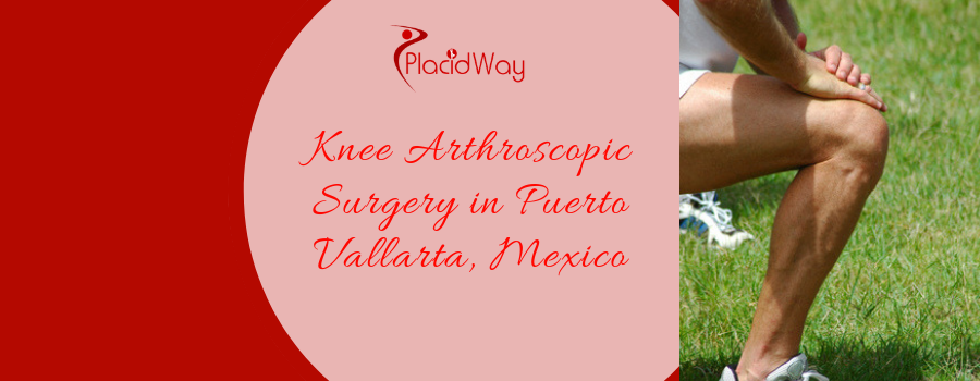 Knee Arthroscopic Surgery in Puerto Vallarta, Mexico
